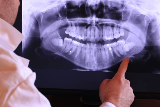 Best Teeth Whitening  in El Reno, OK