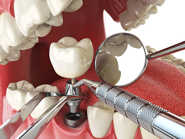 Best Urgent Tooth Repair  in El Reno, OK